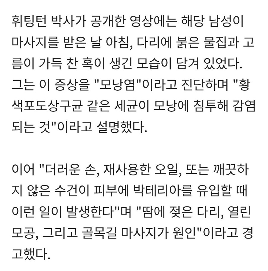 동남아 마사지 받았다가 피부썩어_3.jpg