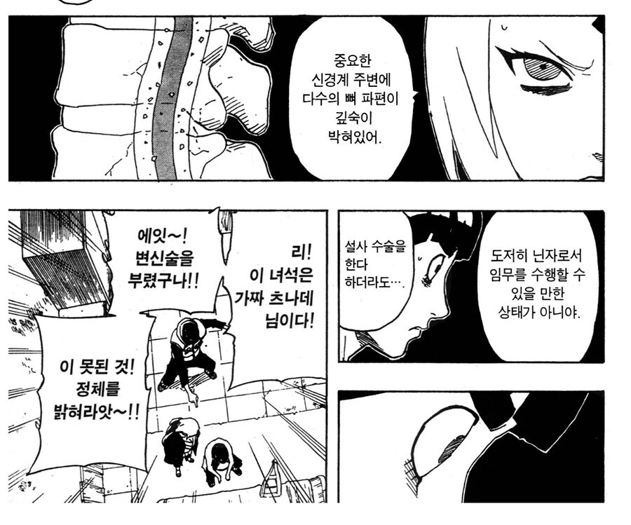 나루토 츠나데가 인생에서 가장 어처구니없었을 순간_6.jpg