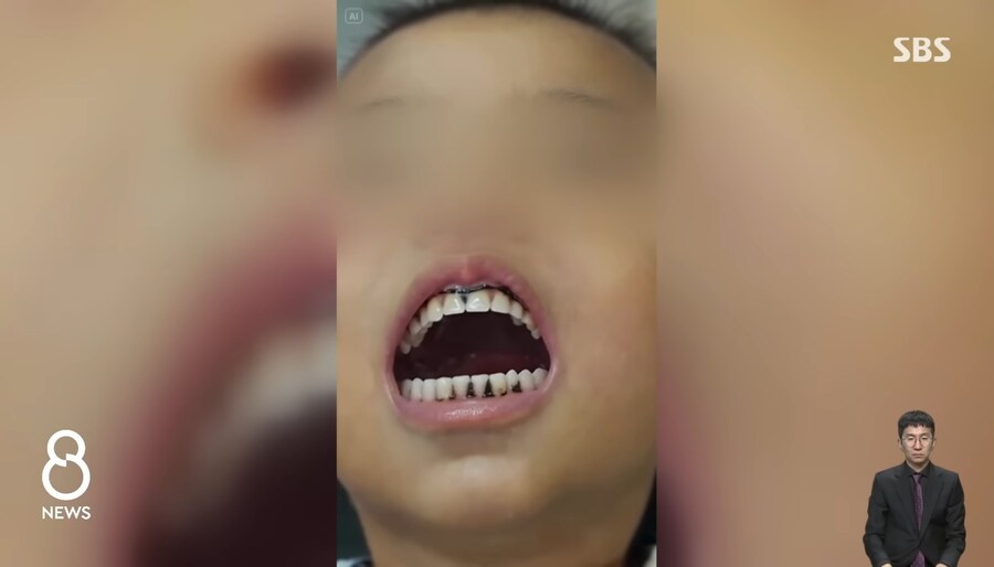 대륙의 급식 근황_2.jpg