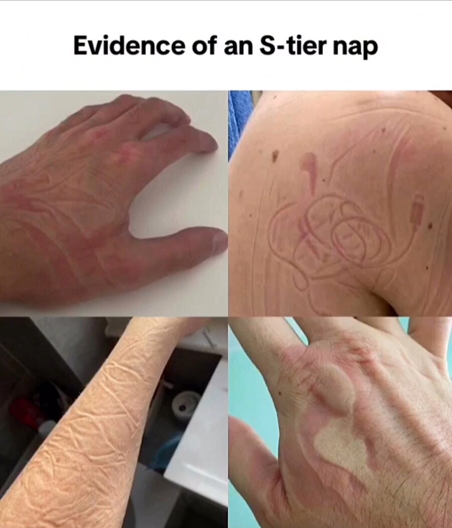 개꿀잠 잤다는 증거_1.jpg
