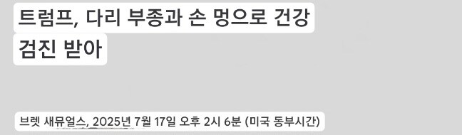 트럼프, 건강검진 결과 정맥질환 확인_1.jpg