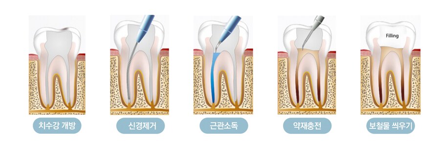 의외로 알맞는 치료방법_2.png