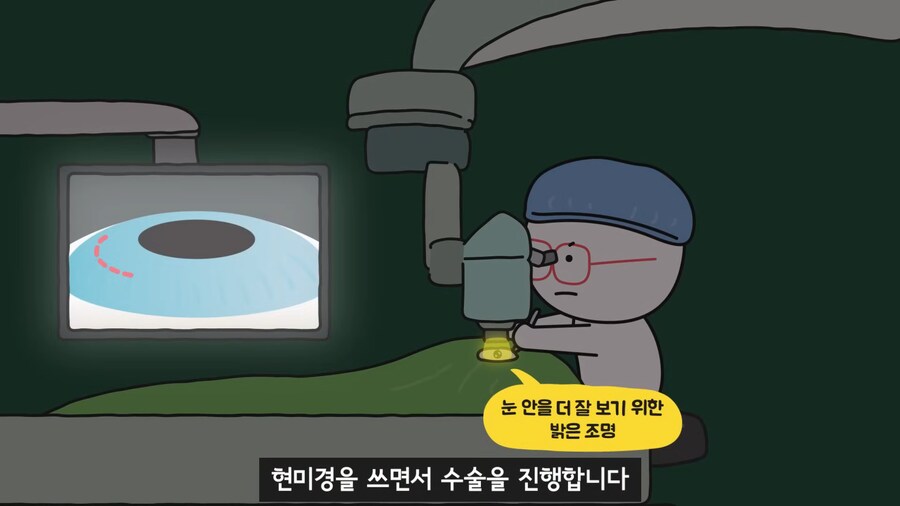 안과 의사들이 안경을 쓰는 이유.jpg_25.png