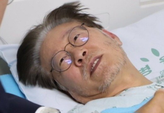 아. 그럼 고환율이라는 말은 고환의 성능을 말하는 건가요?_1.jpg