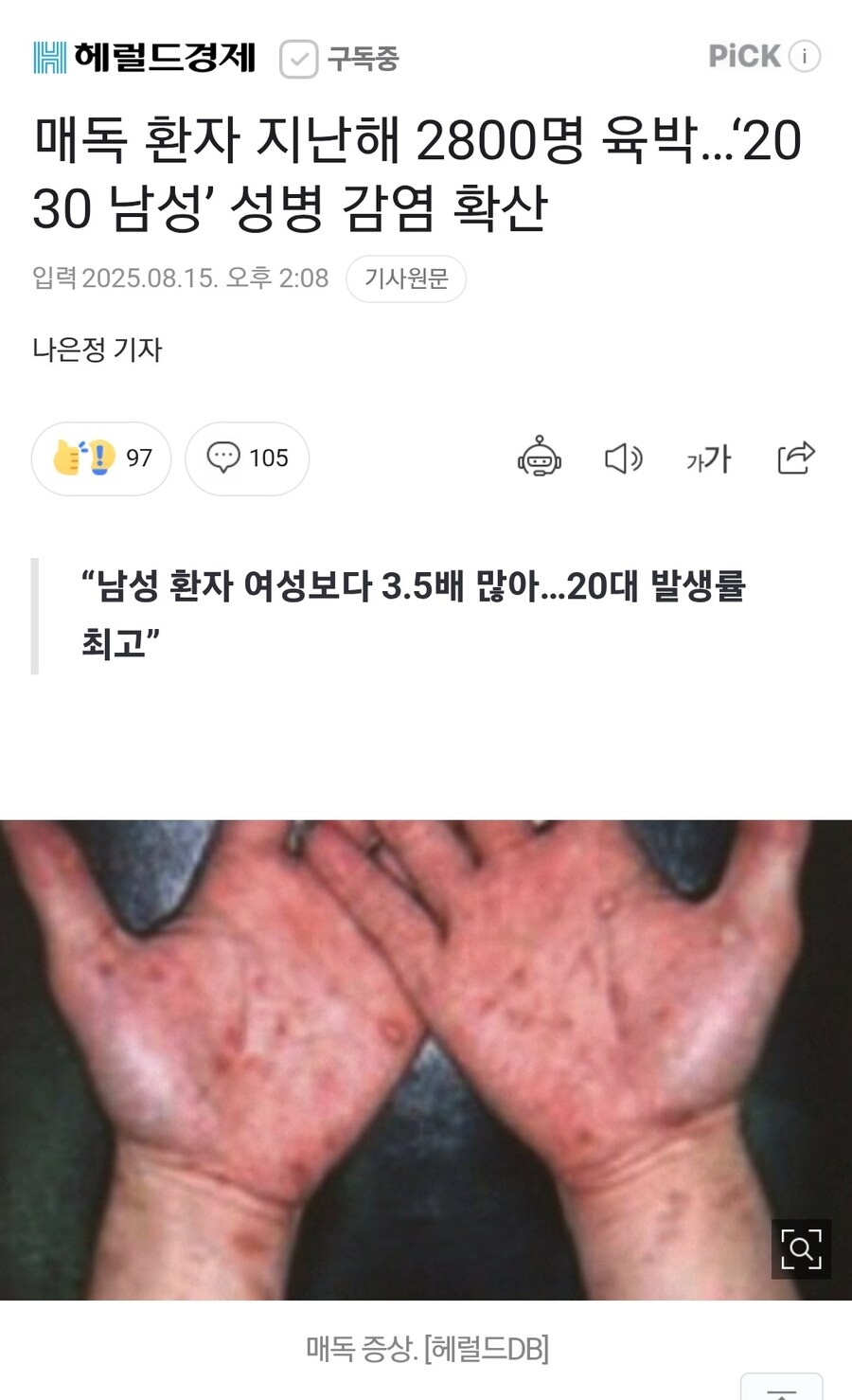 뉴스) 한국에서 매독 유행 중_1.jpg