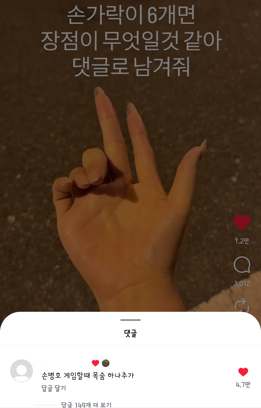 의외로 잘모르는 손가락 6개일때 장점_1.jpg