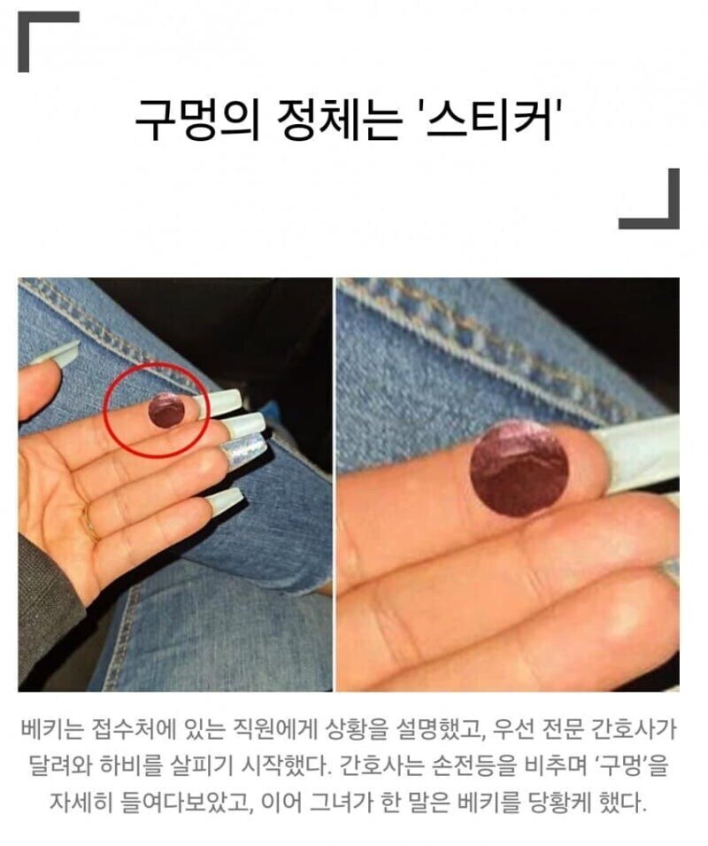 아기 입천장에 구멍이 뚫린 줄 알고 식겁한 엄마_2.jpg