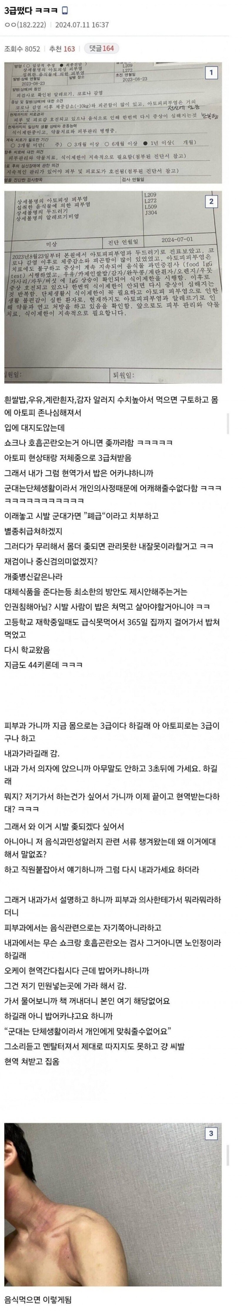 쌀밥, 우유, 계란, 감자 알레르기인데 현역 판정_1.jpg