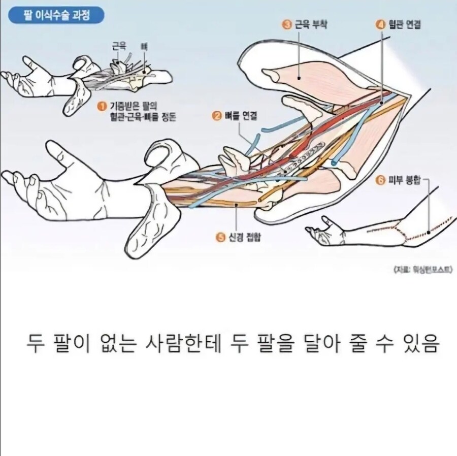 고도로 발달 한 현대의학으로도 불가능한 영역_1.jpg