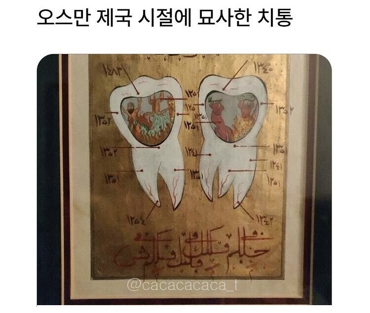 치통의 고통을 묘사한 옛날 그림_1.jpg