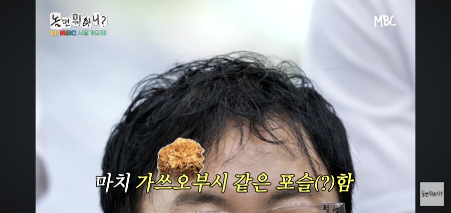 예능)명수형 머리 뒤에서 보면 쯔쯔가무시 올려놓은거 같아요._9.jpg