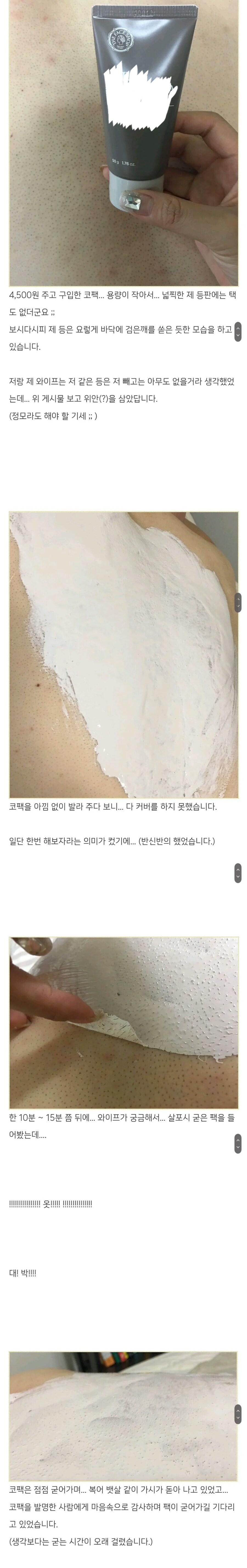 등 잔털 제거 후기.jpg_2.jpg