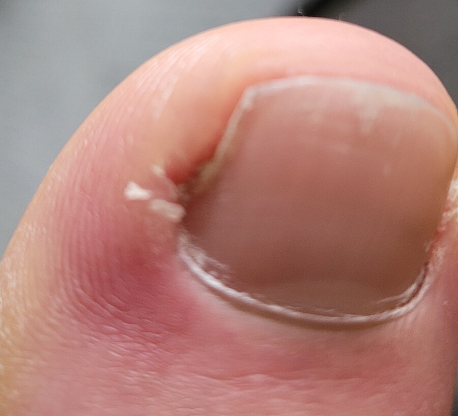 혐) 볼만한것들_7.jpg