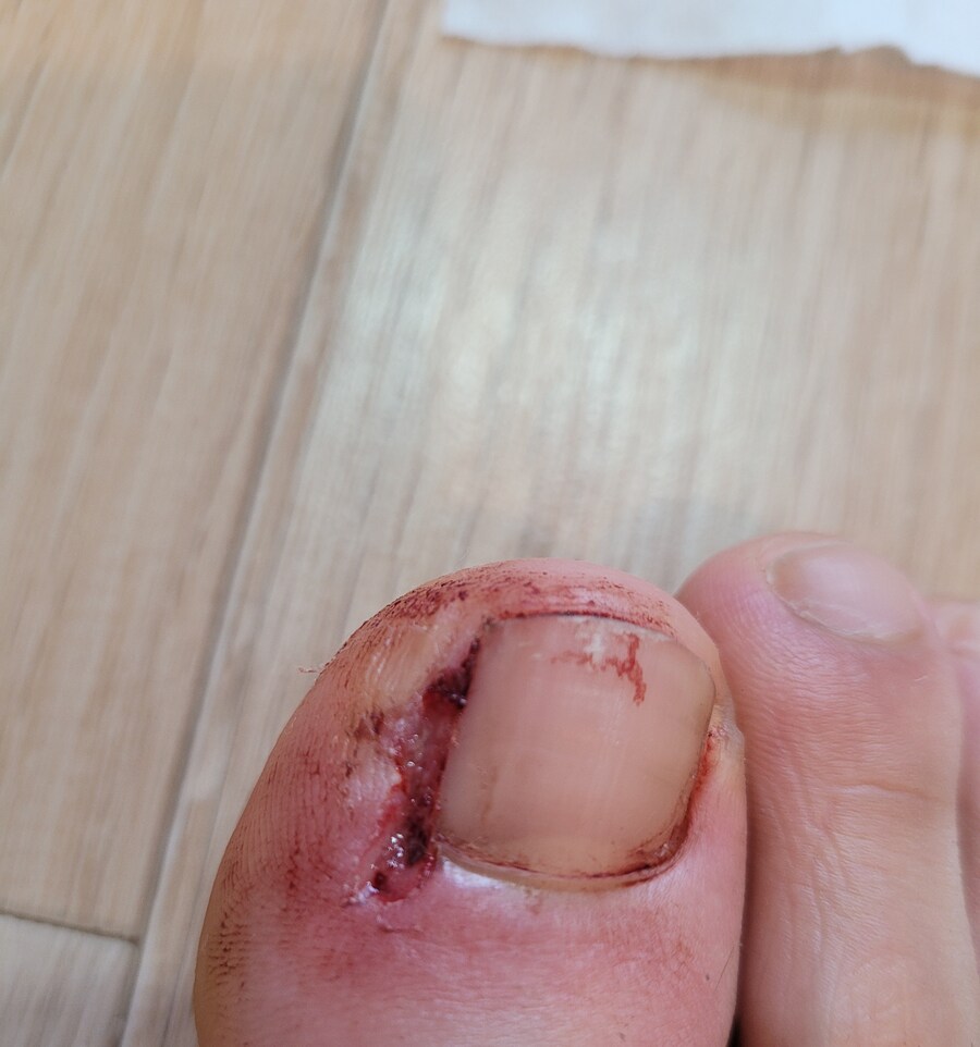 혐) 볼만한것들_9.jpg