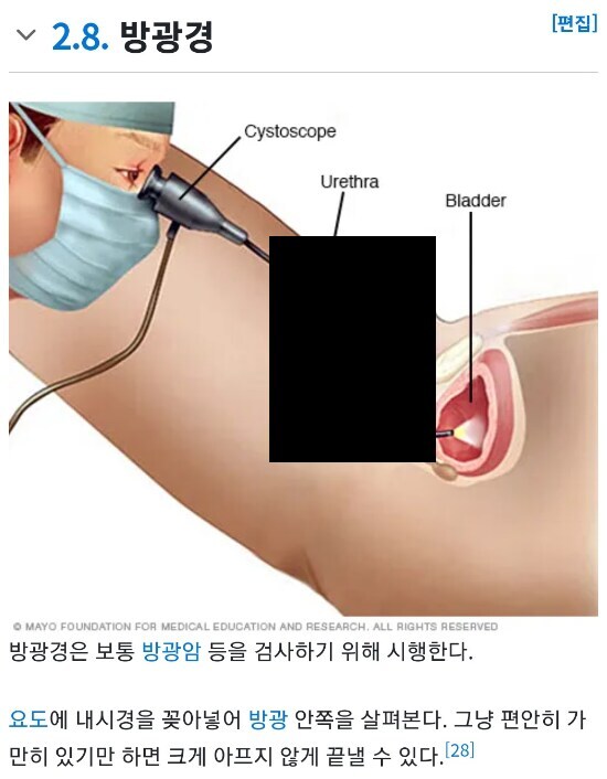 약혐) 아파보이지만 안 아프다고 주장하는 내시경.jpg_2.jpg