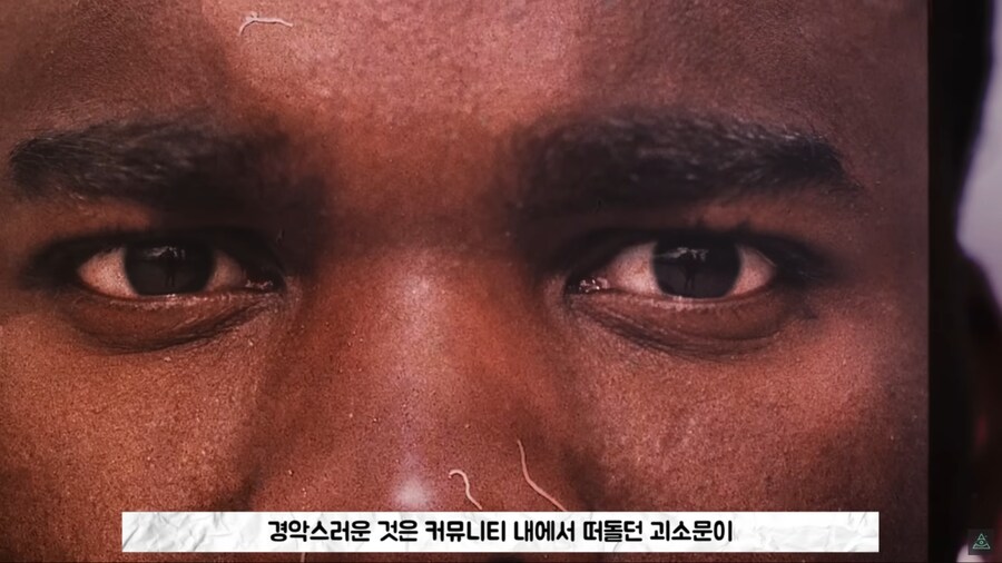 미국에 백신관련 음모론자가 유독 많은 이유_30.png