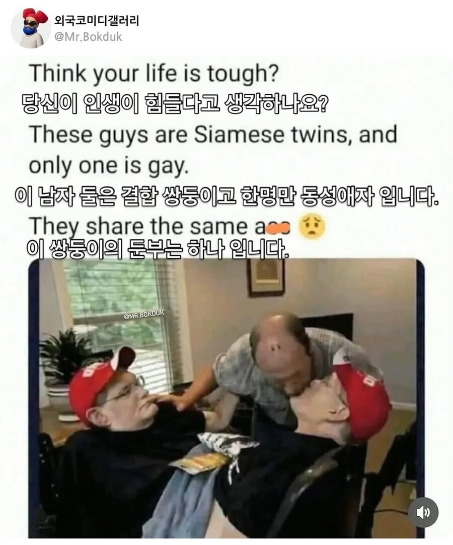 샴 쌍둥이의 성적 취향 문제_1.jpg