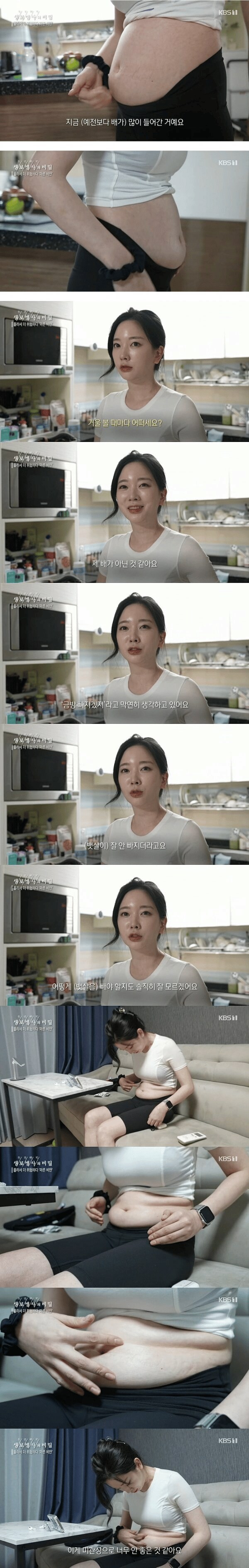 마른 비만女_3.png
