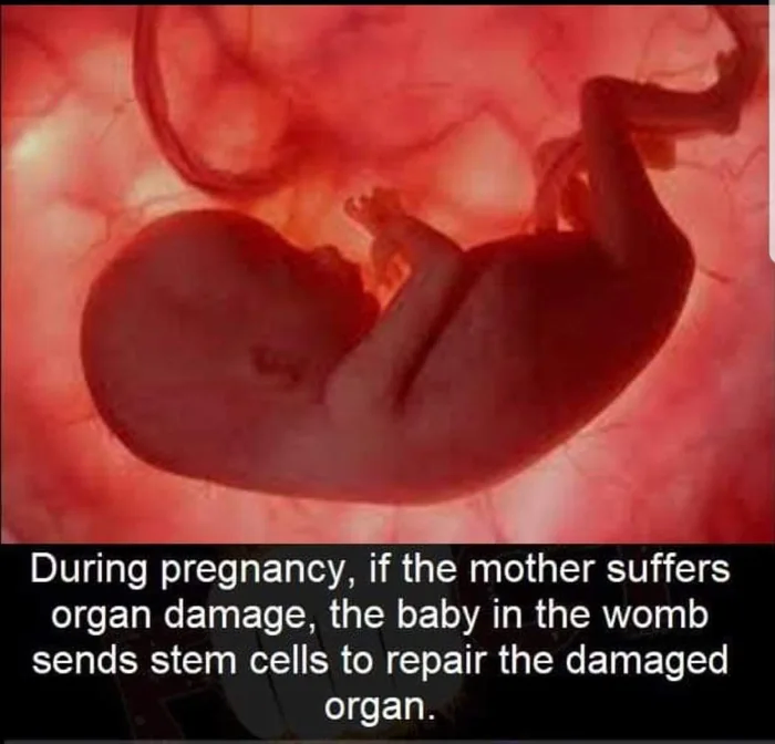 임신중인 산모에게 일어나는 희귀 현상.jpg_1.webp