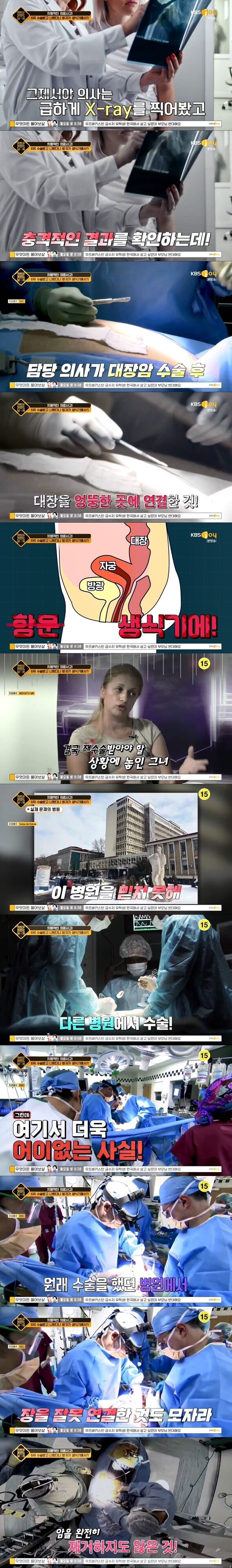 대장암 수술했더니 방귀가 다른곳에서 나온 여자_3.jpg