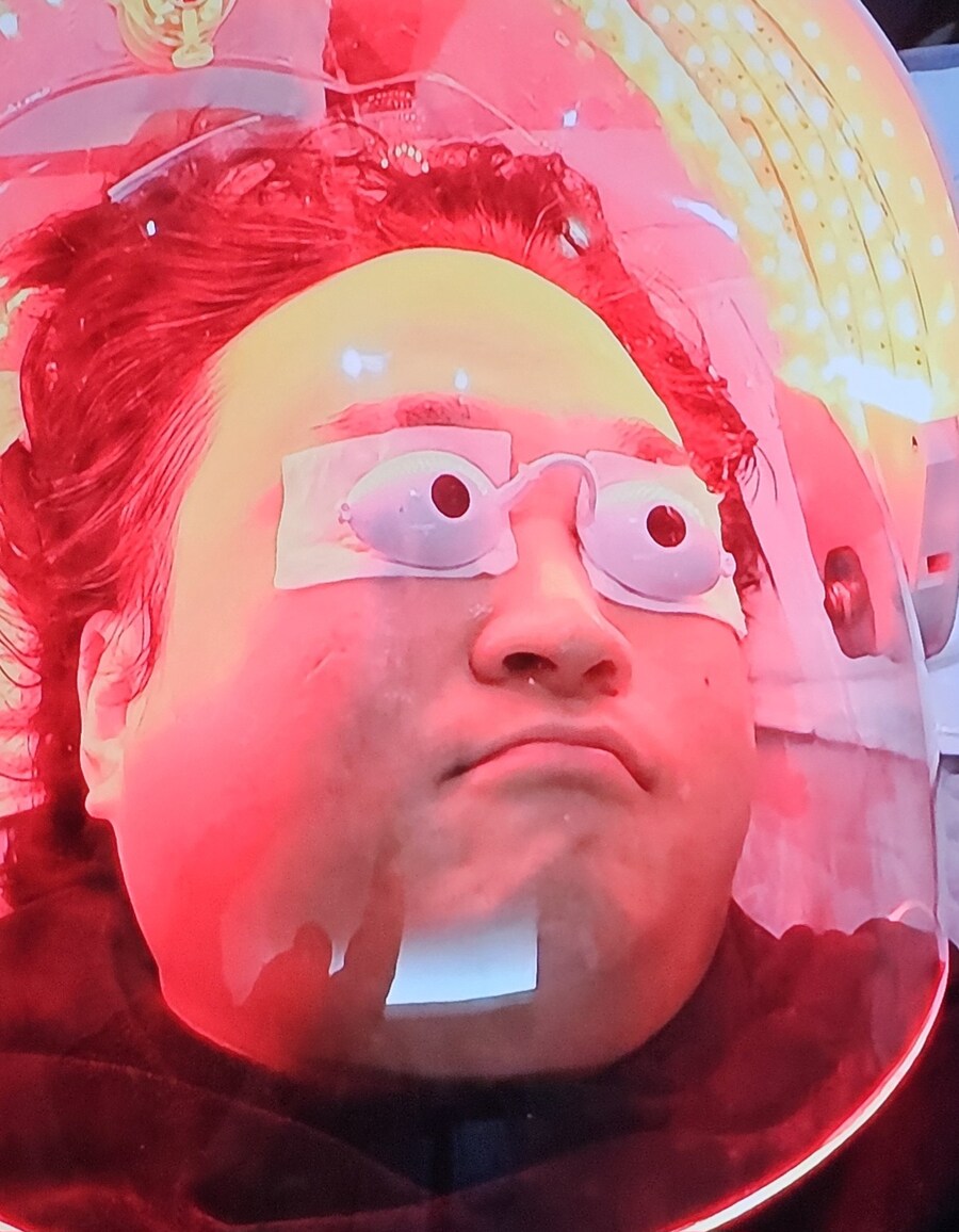 나혼산) 나혼산 멤버의 백반증 치료 화면_1.jpg