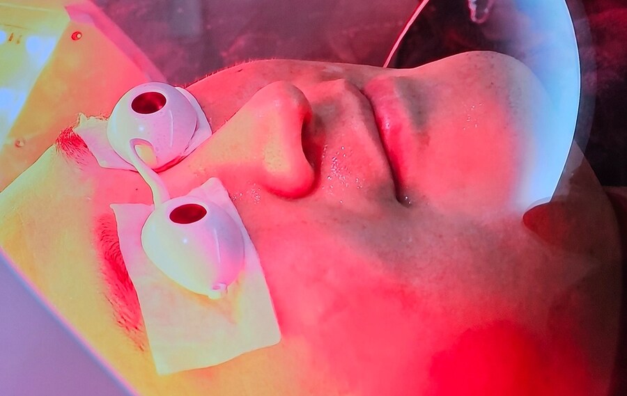 나혼산) 나혼산 멤버의 백반증 치료 화면_2.jpg