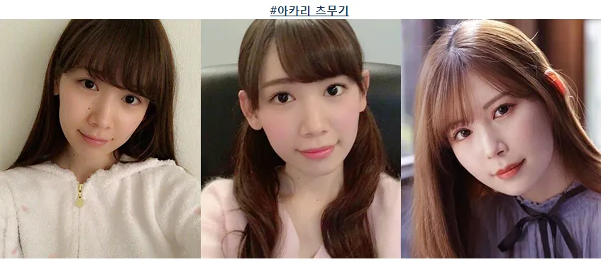 일본도 인정하는 한국의 의술.....jpg_2.webp