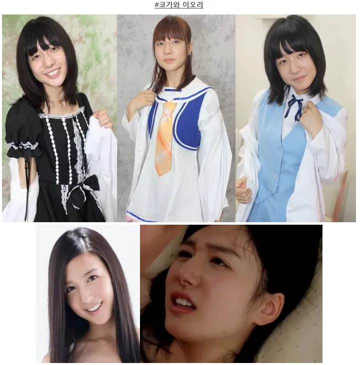 일본도 인정하는 한국의 의술.....jpg_3.webp