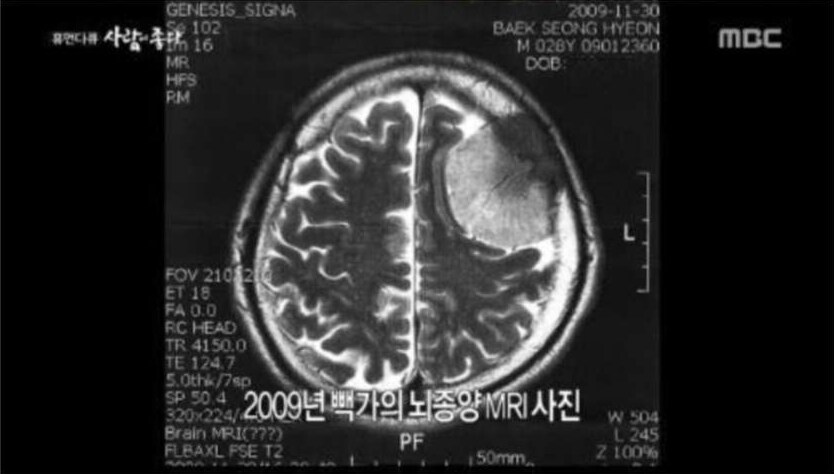 진짜 빽가는 어떻게 살아있는건지 신기할따름임_1.png
