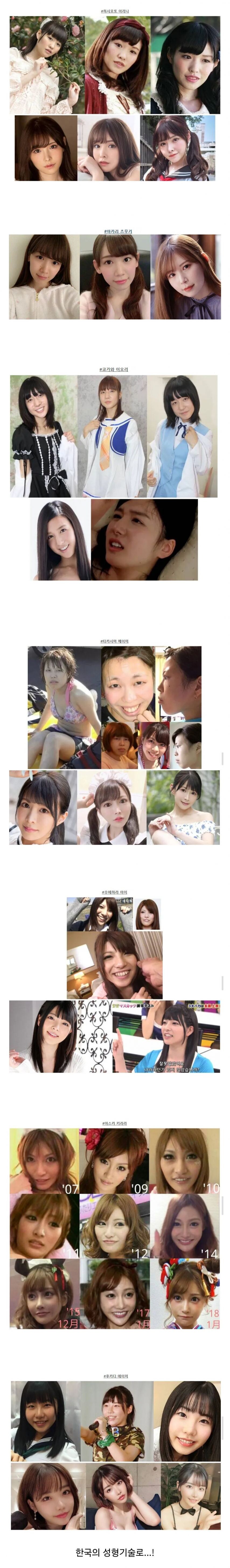 일본도 인정하는 한국의 의술.jpg_1.jpg