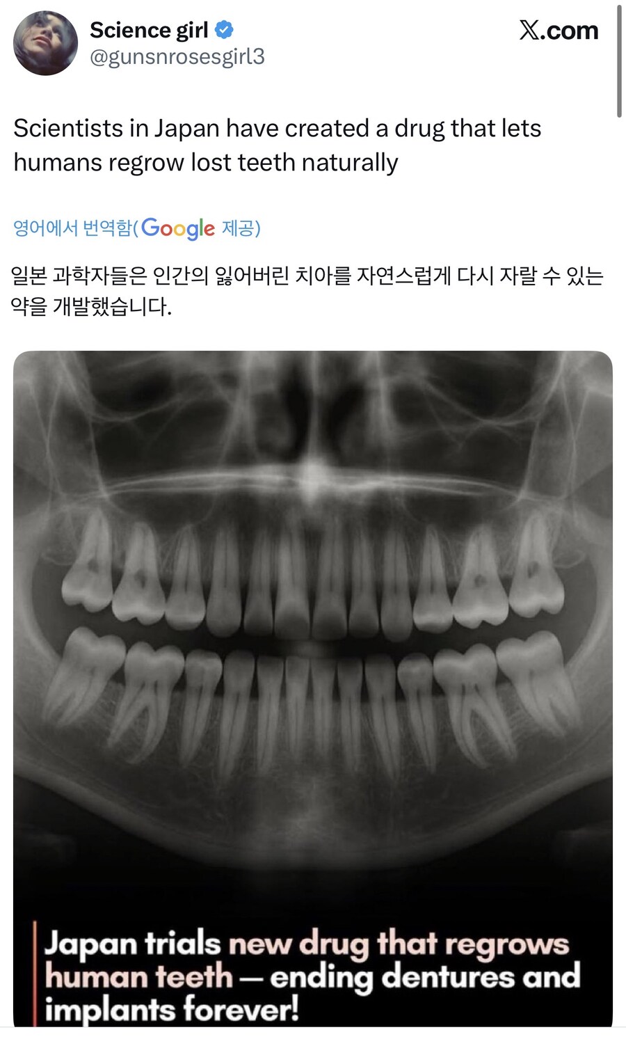 놀라운 발견을 해낸 일본 과학자들 근황.jpg_1.jpg