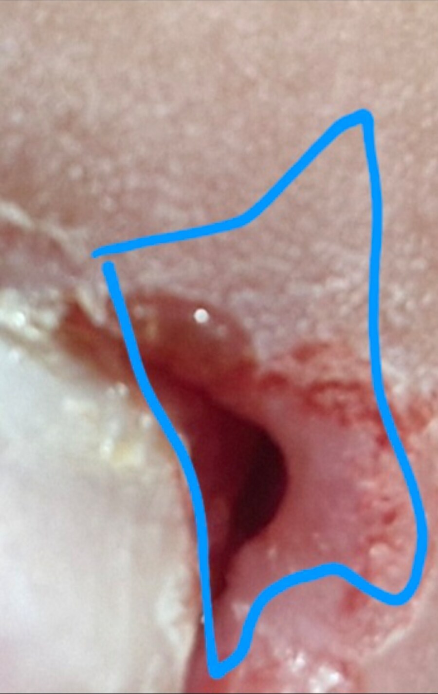 혐) 유게이의 피와 땀_2.jpg