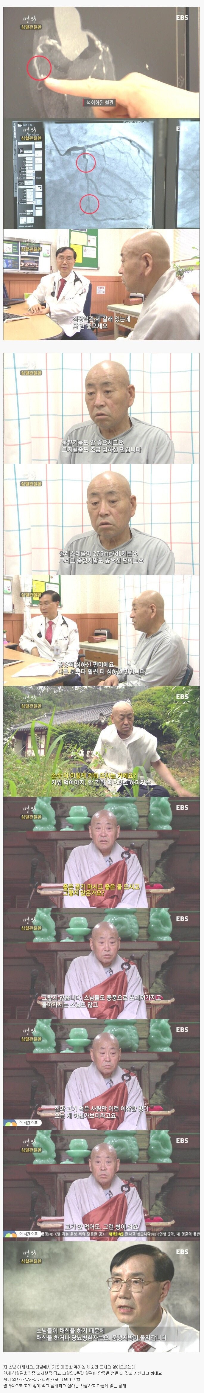 의외로 건실한 승려가 치매 걸리는 이유_2.jpg