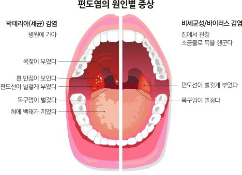 이비인후과 의사가 비행기표 끊을 때 하는 말은?_3.jpg