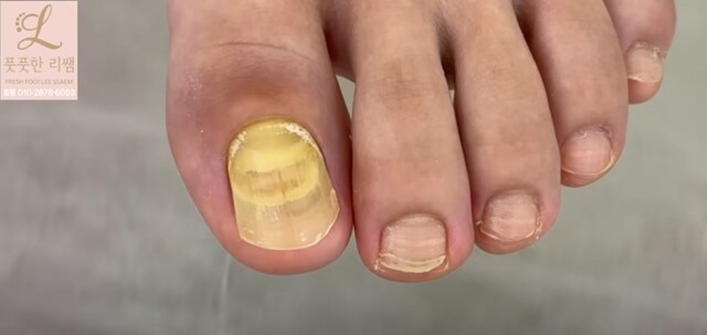 혐) 공부하다가 탄 유튜브 알고리즘_7.png