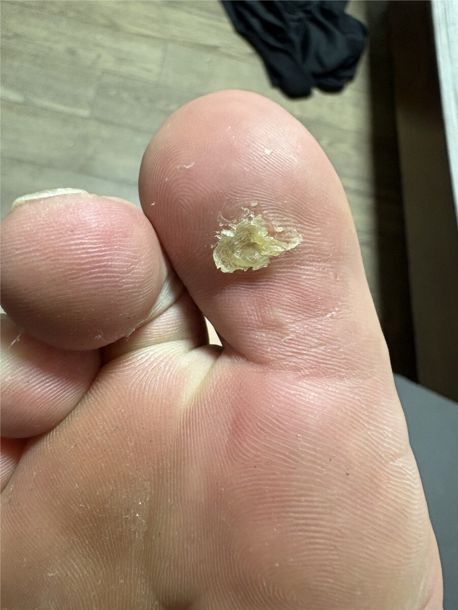 혐) 티눈갤 관우 레전드_1.png