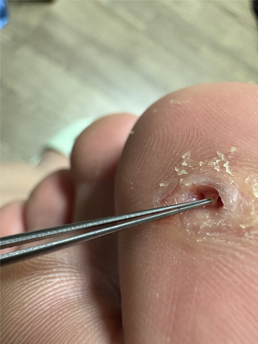 혐) 티눈갤 관우 레전드_6.png