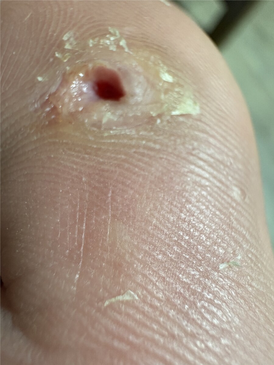 혐) 티눈갤 관우 레전드_7.png