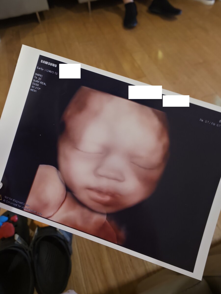 요새 기술력 너무좋네요! 무난이 여동생 사진 공개!_1.jpg