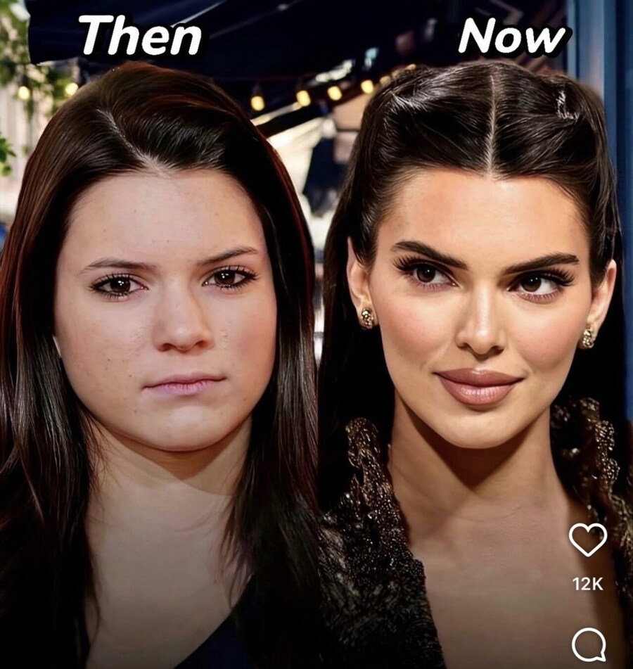 켄달 제너 성형 전후_1.jpg