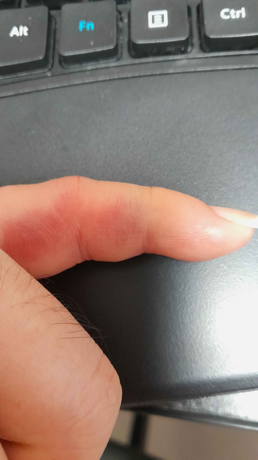 손가락 접질러서 컨트롤키도 못 누르겠다_1.jpg