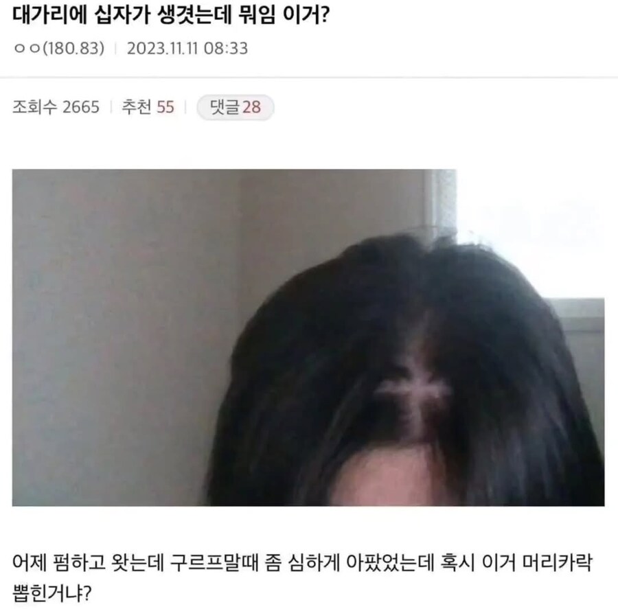 대가리에 십자가 생겼는데 뭐임 이거?.jpg_1.jpg