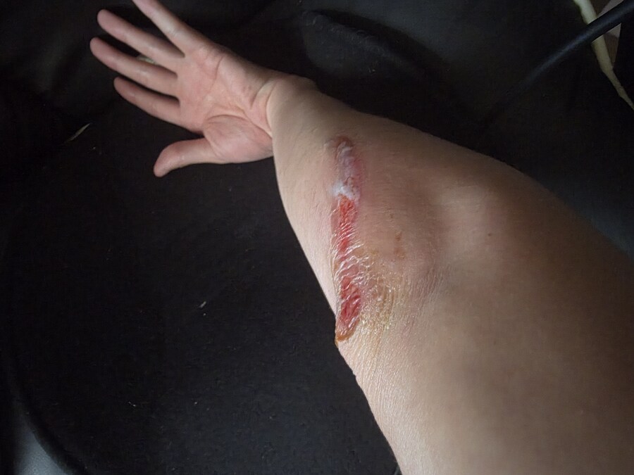 혐) 노인 센터에서 낙상사고 일어났다._1.jpg