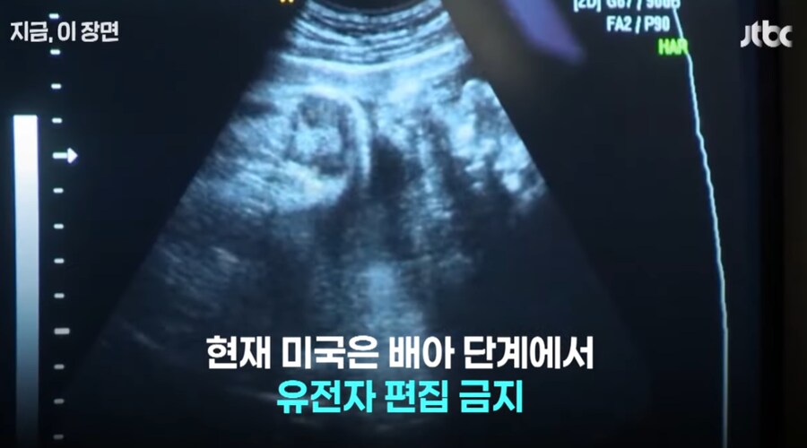 '유전자 조작 아기' 논란._8.png