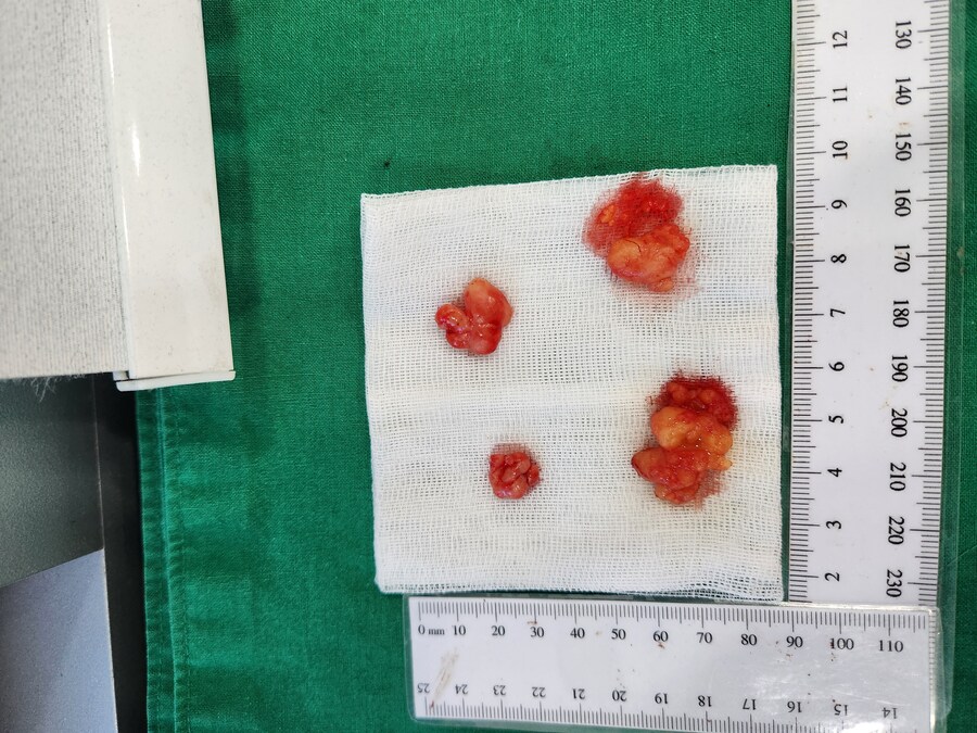 [혐] 아까 수술 결과물 올려도 된다고 하길래_1.jpg