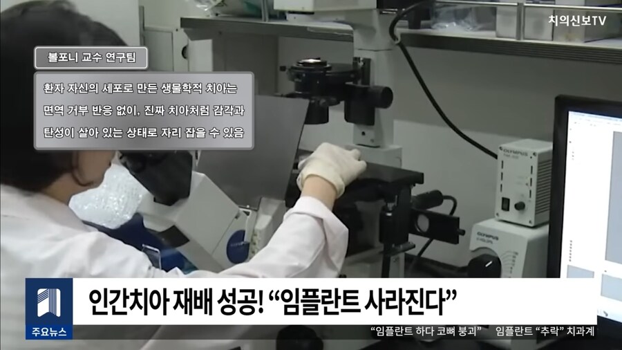 인간치아 재배 성공, 임플란트 사라진다_2.jpg