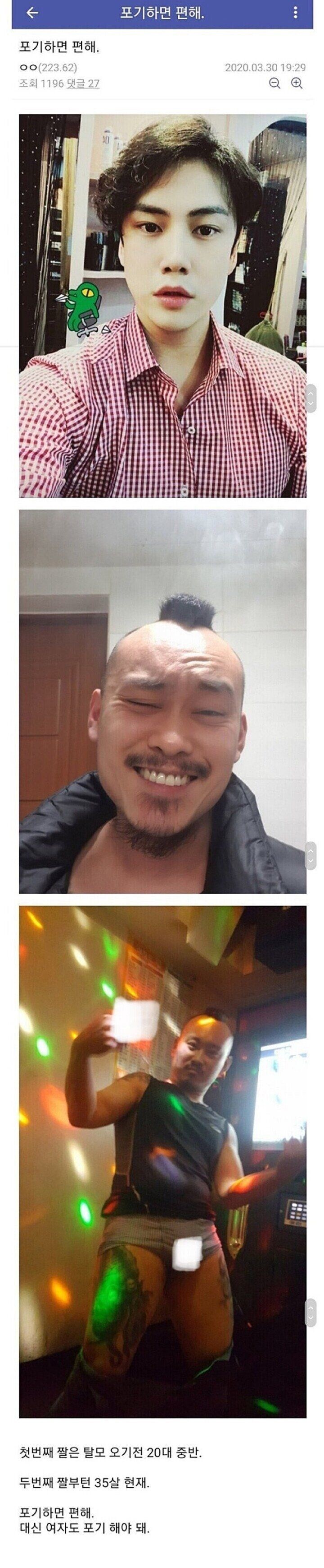 탈모에 집착하지 않고 포기하면 인생이 달라지더라_1.jpg