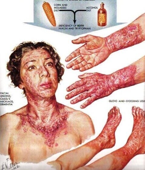 혐주의)조선에서 옥수수가 주식이 될 수 없었던 이유_4.jpg