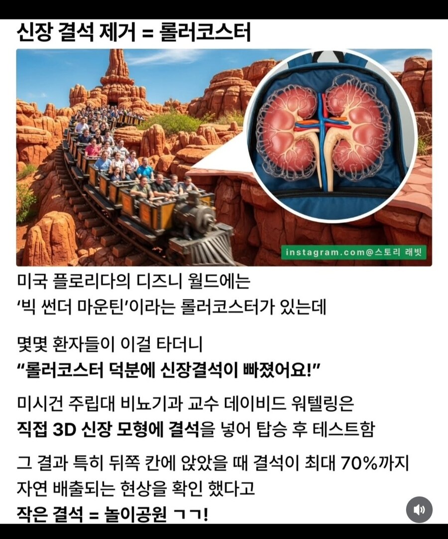 획기적인 신장결석 제거법_1.jpg