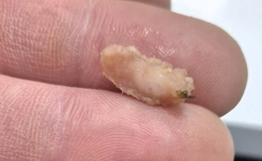 삼김 먹을 때 조심해야하는 것_1.jpg